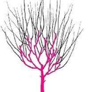 Kiedy można przycinać drzewo bez zezwolenia? Oto, co mówi prawo