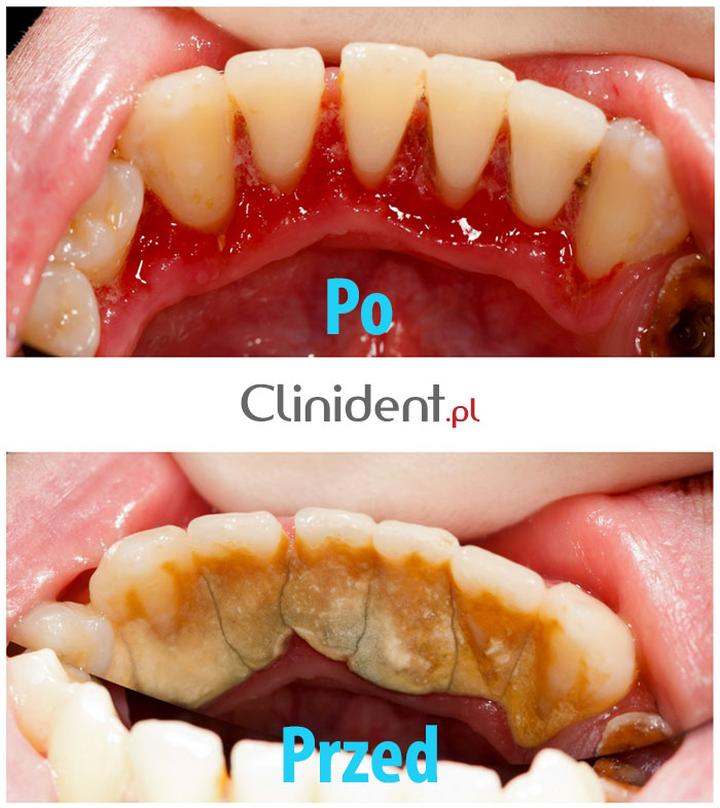 Usuwanie kamienia z kabiny prysznica